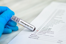 Nguy cơ Chikungunya xâm nhập, Bộ Y tế yêu cầu tăng cường phòng chống