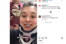 Một phụ nữ Anh gần như bị liệt sau khi ngáp quá mạnh và gãy cổ