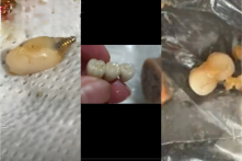 Trung Quốc: Người dân Cát Lâm phát hiện “3 chiếc răng người” trong xúc xích
