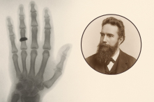 130 năm phát hiện ra tia X: Từ lịch sử đến hiện tại và tương lai