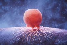 Gần 1 trong 10 người trưởng thành Mỹ từng được chẩn đoán mắc ung thư – Khảo sát