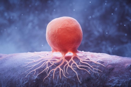 Gần 1 trong 10 người trưởng thành Mỹ từng được chẩn đoán mắc ung thư – Khảo sát