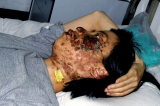 Một bức ảnh hủy dung gây chấn động thế giới, phơi bày tội ác tra tấn của ĐCSTQ