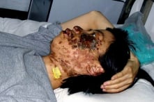 Một bức ảnh hủy dung gây chấn động thế giới, phơi bày tội ác tra tấn của ĐCSTQ Một bức ảnh hủy dung gây chấn động thế giới, phơi bày tội ác tra tấn của ĐCSTQ