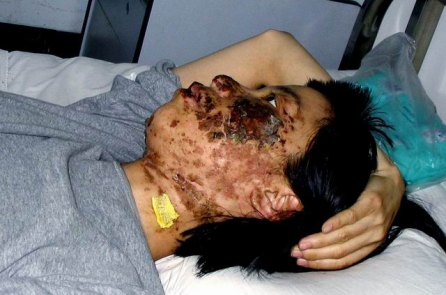 Một bức ảnh hủy dung gây chấn động thế giới, phơi bày tội ác tra tấn của ĐCSTQ
