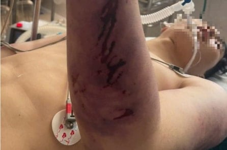 Vụ học viên trung tâm công tác xã hội bị đánh đến chết não: Tạm giữ hình sự 8 người