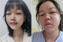 Nạn nhân vắc-xin ở Hồ Bắc chịu đựng đàn áp: Kiệt quệ cả thể chất lẫn tinh thần