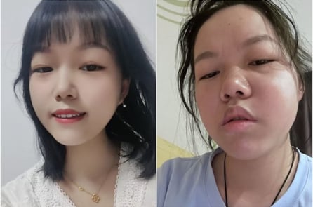 Nạn nhân vắc-xin ở Hồ Bắc chịu đựng đàn áp: Kiệt quệ cả thể chất lẫn tinh thần