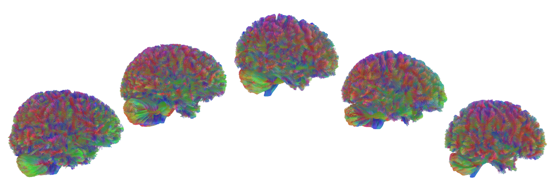 5 giai đoạn phát triển não bộ của con người