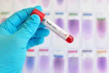 Virus Nipah có thể gây đại dịch? Viện Virus Vũ Hán công bố thuốc điều trị hiệu quả