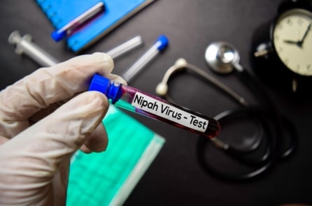 Bộ Y tế nói gì về bệnh do virus Nipah?