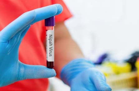 Lợn, bò, dê, trâu, chó, mèo đều có thể nhiễm virus Nipah