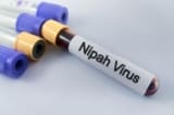 Virus Nipah bùng phát ở Ấn Độ, TP.HCM ra thông báo mới