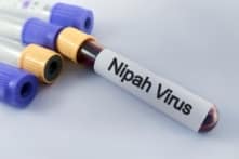 Virus Nipah bùng phát ở Ấn Độ, TP.HCM ra thông báo mới