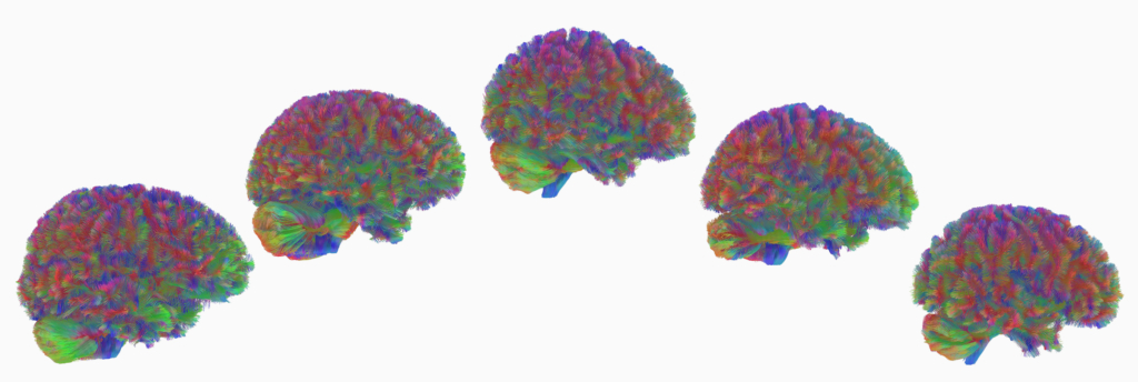 5 giai đoạn phát triển não bộ của con người