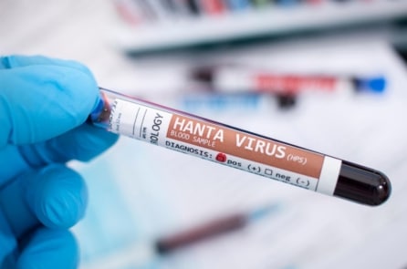 Bộ Y tế cảnh báo nguy cơ virus Hanta lây từ chuột 
