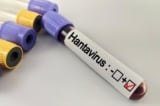 Du thuyền bùng phát Hantavirus, Mỹ điều chuyên cơ đưa 17 hành khách về theo dõi nghiêm ngặt