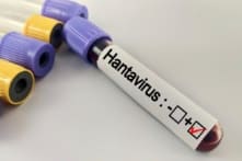 Du thuyền bùng phát Hantavirus, Mỹ điều chuyên cơ đưa 17 hành khách về theo dõi nghiêm ngặt
