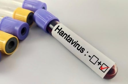 Du thuyền bùng phát Hantavirus, Mỹ điều chuyên cơ đưa 17 hành khách về theo dõi nghiêm ngặt