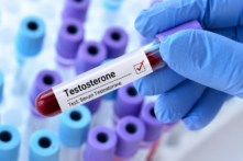 Testosterone có thể làm chậm sự phát triển của ung thư não
