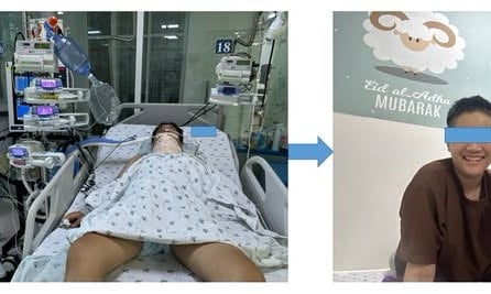 Nam sinh Lâm Đồng treo cổ vì bị bạo lực học đường hồi phục kỳ diệu