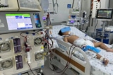 Uống thuốc hạ sốt quá liều, bé trai 5 tuổi bị suy gan cấp 