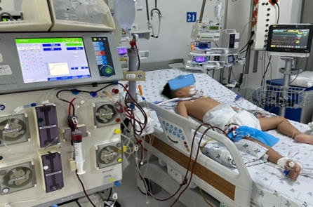 Uống thuốc hạ sốt quá liều, bé trai 5 tuổi bị suy gan cấp Uống thuốc hạ sốt quá liều, bé trai 5 tuổi bị suy gan cấp